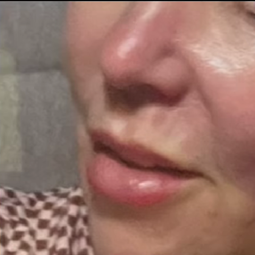 Después